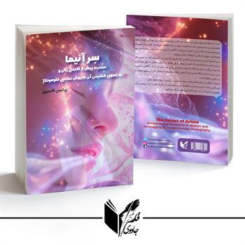 سر آنیما